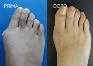 Foto prima e dopo - 12° Caso Clinico