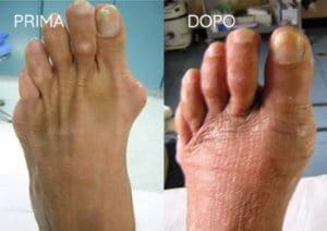 Foto prima e dopo - 2° Caso Clinico