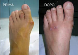 Foto prima e dopo - 5° Caso Clinico