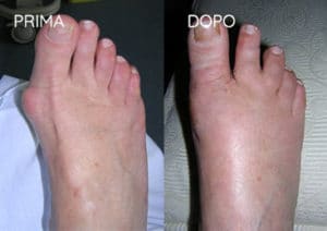 Foto prima e dopo - 6° Caso Clinico